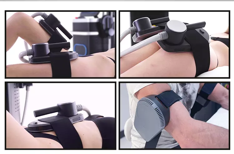 EMS Body Sculpting Machine Before & After the Treatments