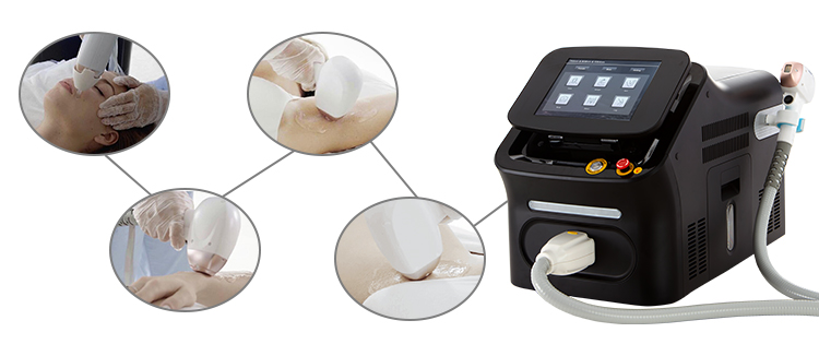 Portable Laser Hair Removal Equipment Portable Laser Hair Removal Equipment