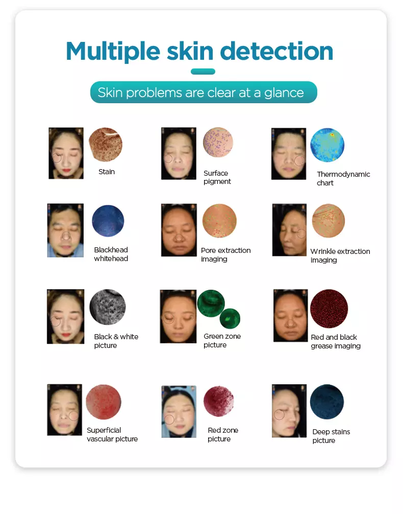 3D Skin Analysis 3D Skin Analysis