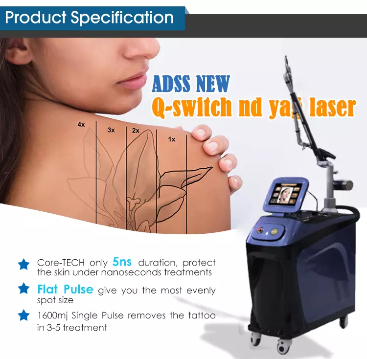 Q-Switched ND YAG Laser