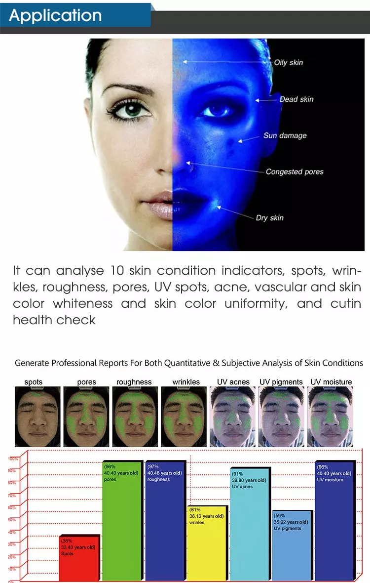 3D Skin Analysis Machine 3D Skin Analysis Machine