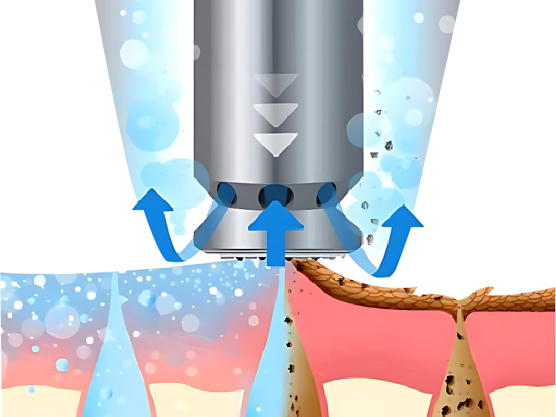 Enhanced Treatment Efficiency